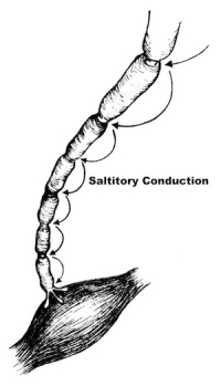 Chronic Radiculopathy | Lumbar Spine | Spine Specialist