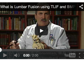 What is Lumbar Fusion