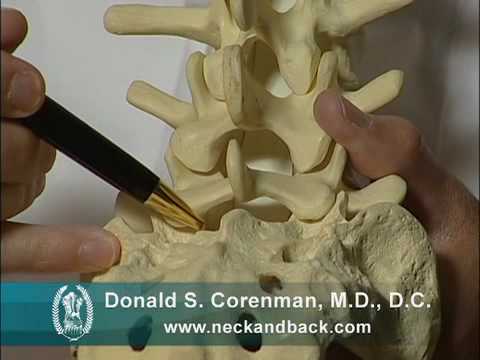 Explanation of Microdiscectomy for Lumbar Disc Herniation and Leg Pain