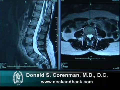 Understanding an MRI of the Normal Lumbar Spine