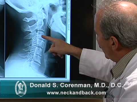Understanding X-rays of the Cervical Spine