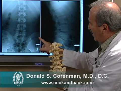 Understanding X-rays of the Lumbar Spine