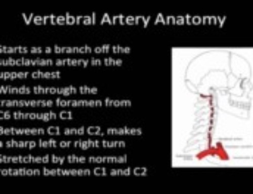 Ganglion Cysts | Lumbar Spine | Spine Specialist | Vail, Aspen, Denver CO