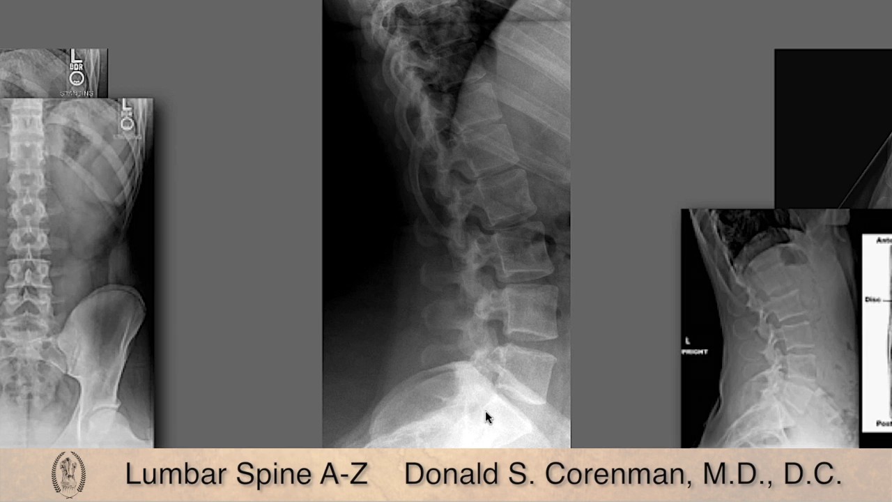 Lumbar Spine Course